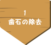 1 歯石の除去