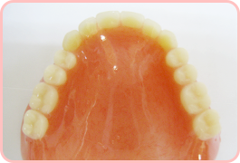 総入れ歯（保険適用）